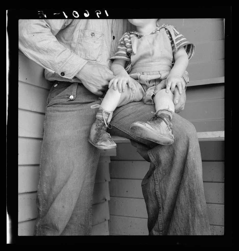 This black and white photograph shows an adult, likely a father figure, sitting on a porch swing with his legs extended. He is wearing jeans and a denim shirt. In the lap of this person sits a child who appears to be around 2-5 years old based on size. The child has suspenders over striped clothing that suggests they may have been working or playing outdoors as their clothes are notably dirty. Their feet show signs of club foot, which is evident from deformed toes and visible orthopedic devices known as splints inside the shoes, likely for medical treatment purposes.

The setting seems to be a porch area with vertical siding typical in rural housing settings that could suggest it's outside an agricultural dwelling or barn given its rustic nature. The photograph has handwritten text on the top which is partially obscured but suggests context such as date (1932) and possibly location within Tulare County California, indicating this was likely taken during a time of great hardship for many due to poverty associated with the Great Depression.

The image captures an intimate moment between caregiver and child amidst difficult circumstances.
